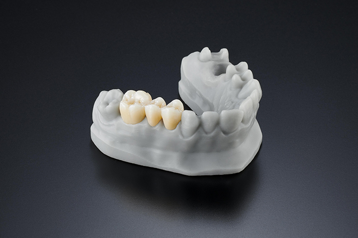 photo of prosthetic teeth